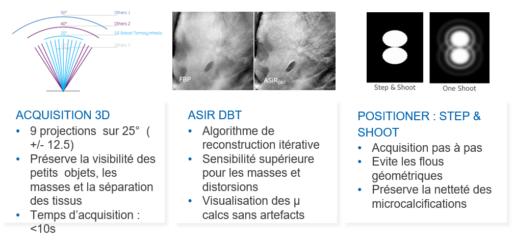 Low-dose tomosynthesis image example