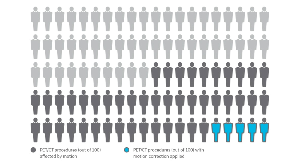Motion-free PET imaging comparison